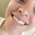 "Smiley" piercing - upper lip frenulum / "web" piercing with an 18g fixed bead ring - done by Lhena - Queen of Hearts, Wailuku, Maui. Septum piercing not by QOH.